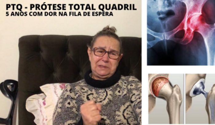 5 anos com o quadril esmagando nervos por falta de Prótese - Vó Angelina