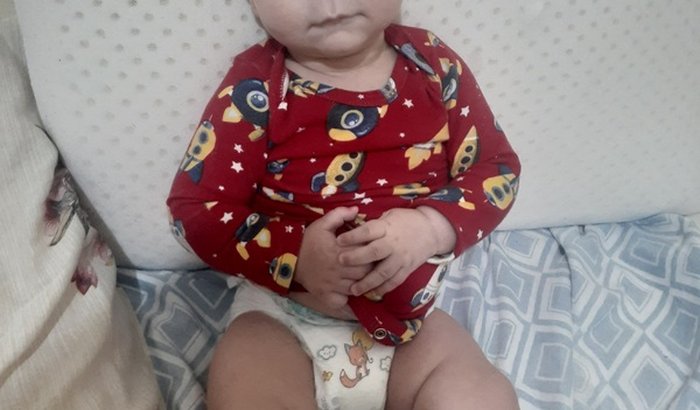 Arthur contra Sindrome de West