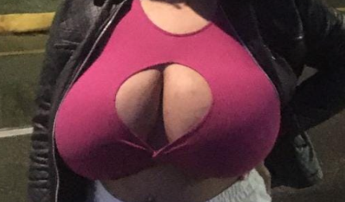 Ajudando a Jaque na redução de mamas!