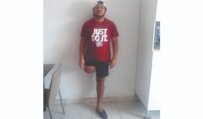 Uma Ajuda com a Prótese