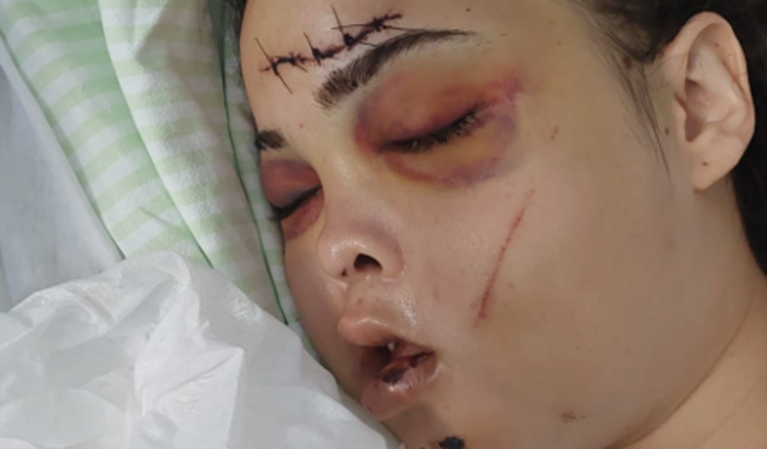 Ajude a Rafaela no pós Cirúrgico