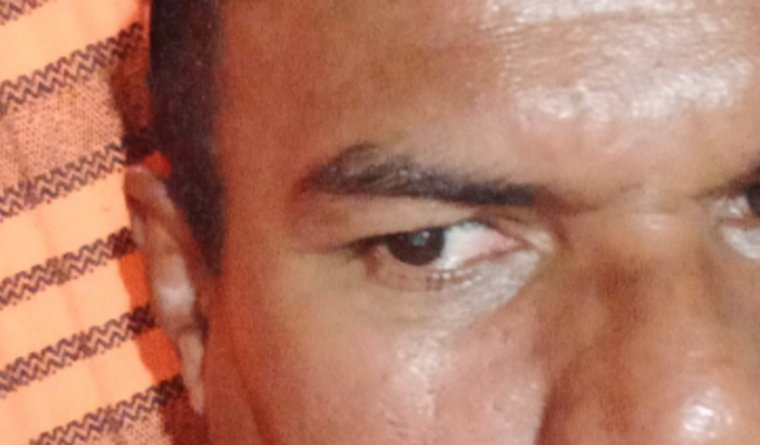 Serogia de olho esquerdo. 