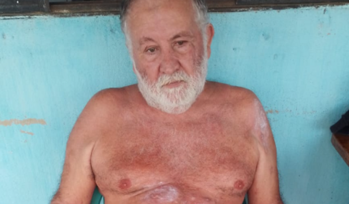 Ajuda para cirurgia e tratamento Beto.