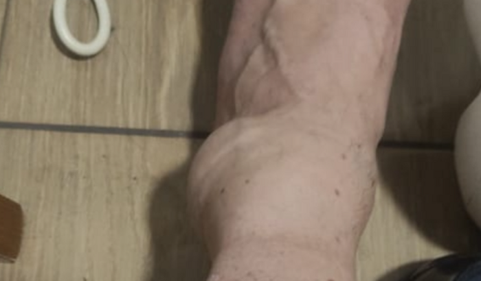 Ajuda para muletas e remédios