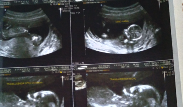 Me ajude a fazer o enxoval pro meu bebê 