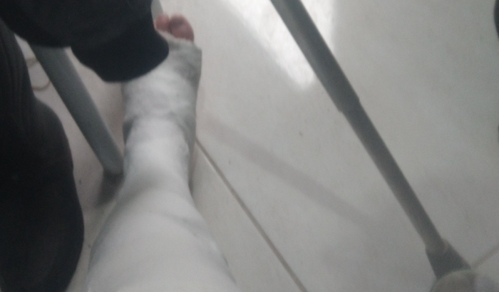 Acidente de moto sou motoboy