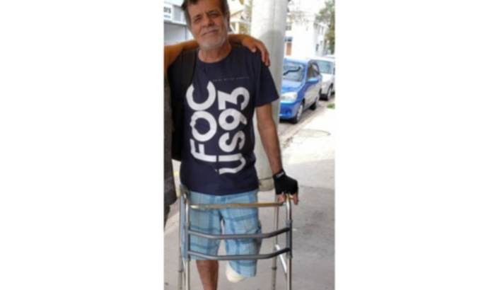Prótese para Carlos Orestes
