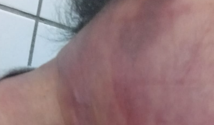 Vaquinha solidária para ajudar nossa amiga Ellen