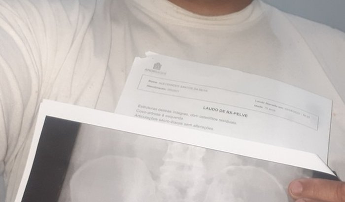 Ajuda para Alex Cirurgia protese de quadril  total esquerdo