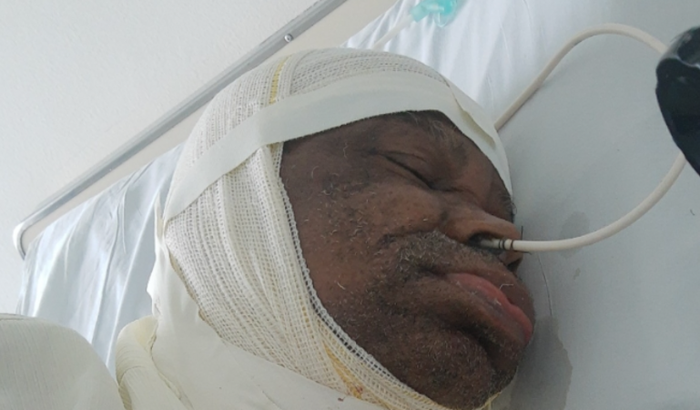 Laringe eletrônica artificial