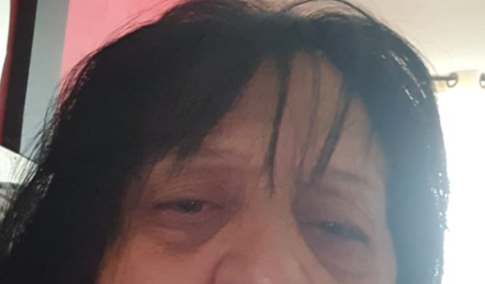 Me ajude a fazer a cirurgia para retirada de um tumor no ovário