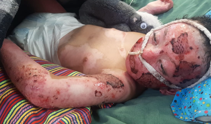 Ajuda para o tratamento do Samuel