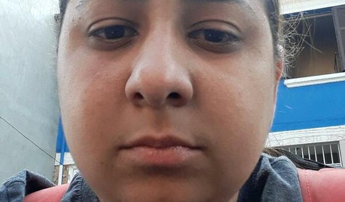 Ajuda para cirurgia de apneia do sono 