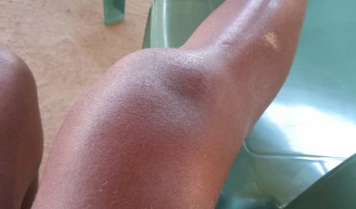 "Preciso fazer a cirurgia  do meu joelho urgente". Me ajude povo de Deus, nao estou aguentando mas de tanta dor...