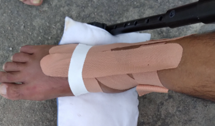 Ajude na cirurgia do Shelton