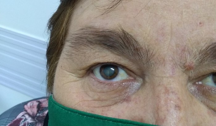 Ajuda para Dona Edilma