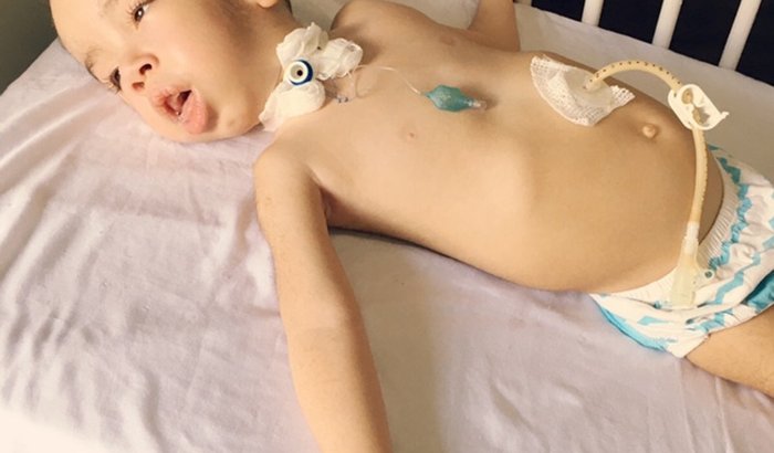 Ajude a comprar a medicação do Breno