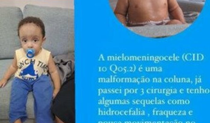 AJUDE O RAFA A DAR SEUS PRIMEIROS PASSOS