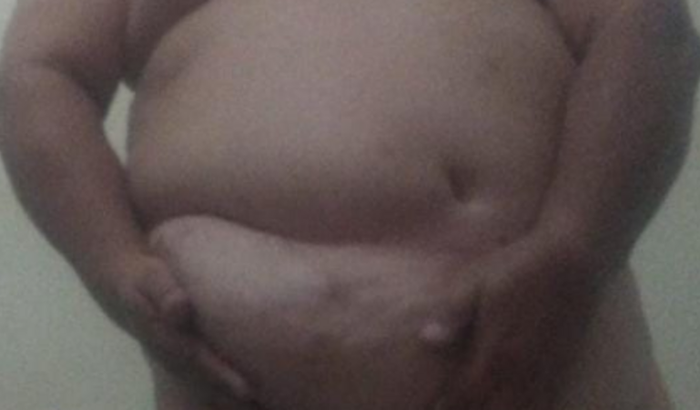 Cirurgia hinguinal emergente