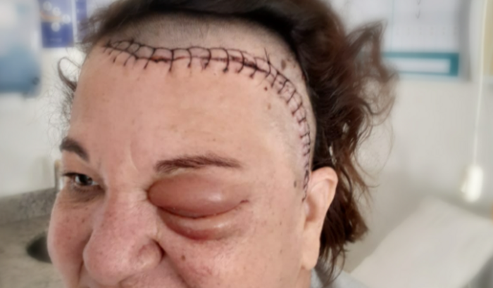 Juntos pela Lucenira