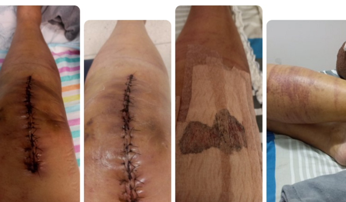 Preciso da minha mobilidade. Vc pode ajudar