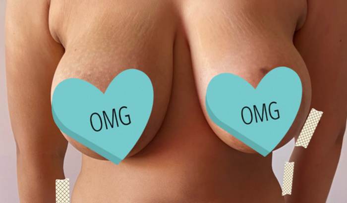 Ajude minha filha a fazer uma redução de mama