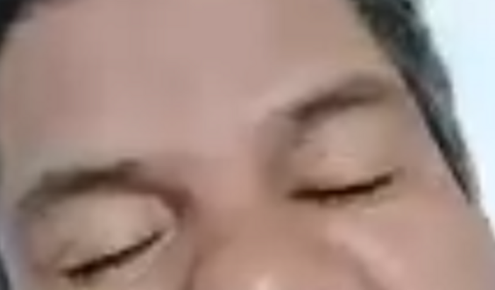 Tratamento da visão