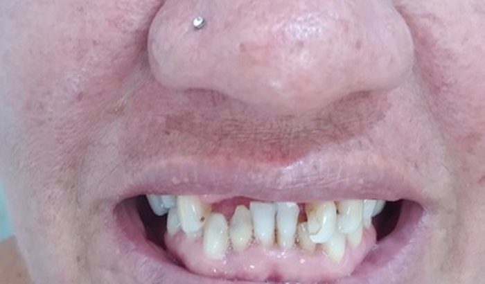 Ajuda eu arrumar meus dentes 