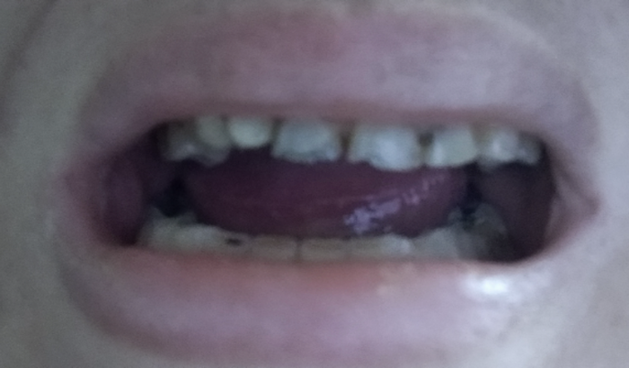 Devolver a auto estima de uma doença mental.