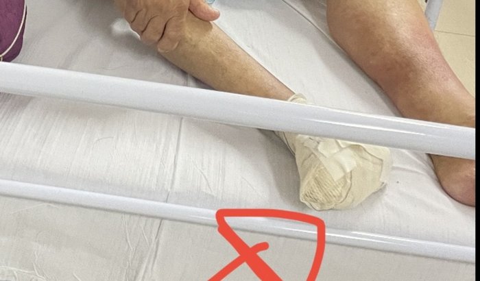 DAOP Artérias Obstruidas 