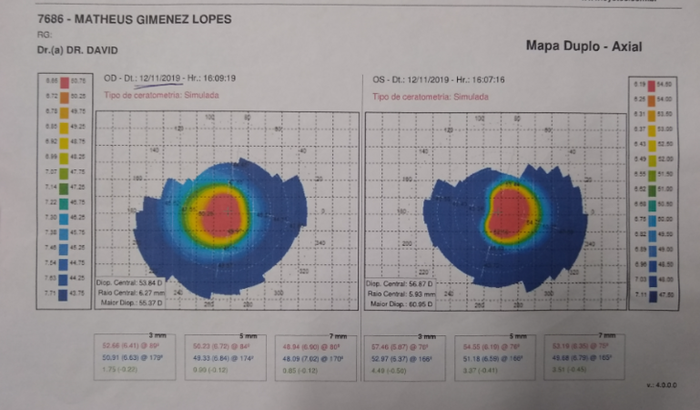 Para uma cirurgia nos olhos