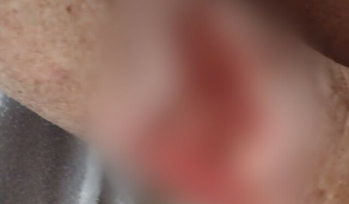 Doação para exames do Seu Cabral