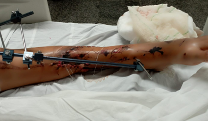 Ajudar minha filha e filho