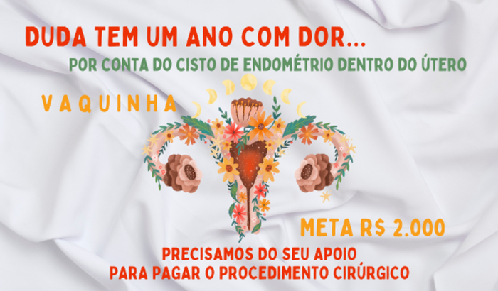 PARA DUDA SEM DOR! (CIRURGIA DO CISTO NO ÚTERO)