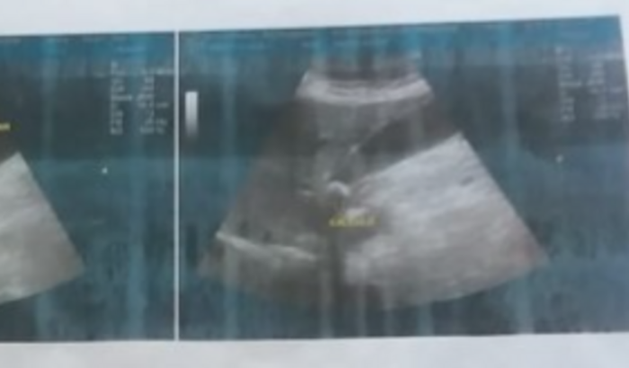 Vaquinha para Cirurgia da nossa Querida irmã Iolanda ! Qualquer valor será bem-vindo desde já agradeço, Deus abençoe.