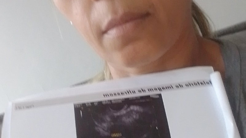 Cirurgia arequistomia 