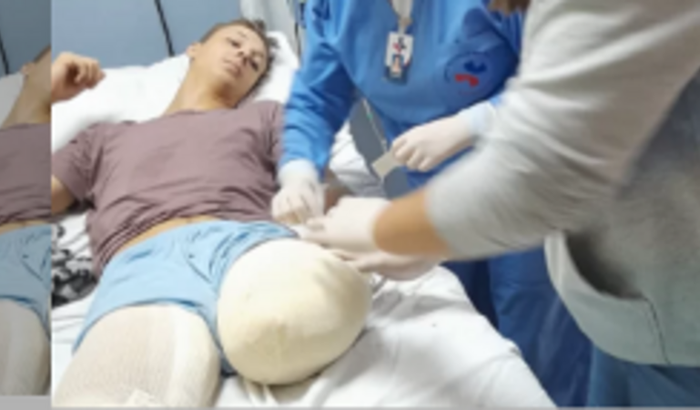 arrecadação para prótese