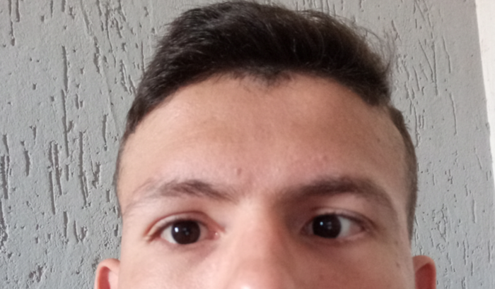 Ajuda para cirurgia de Estrabismo