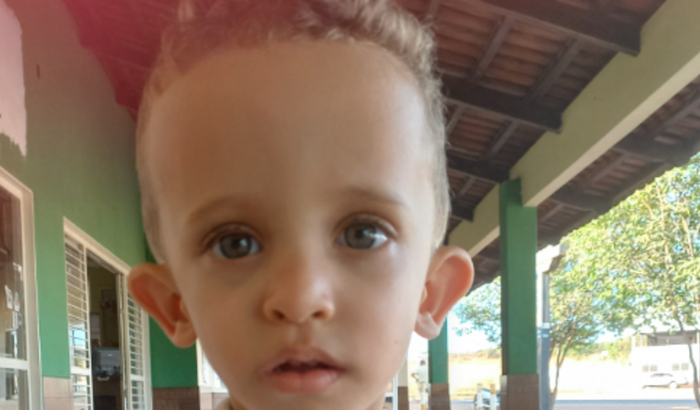 Cirurgia do Serginho