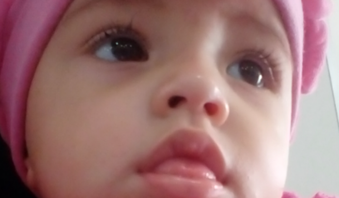 Cirurgia de Adenoidectomia , Tuberctomia e Timpanoctemia