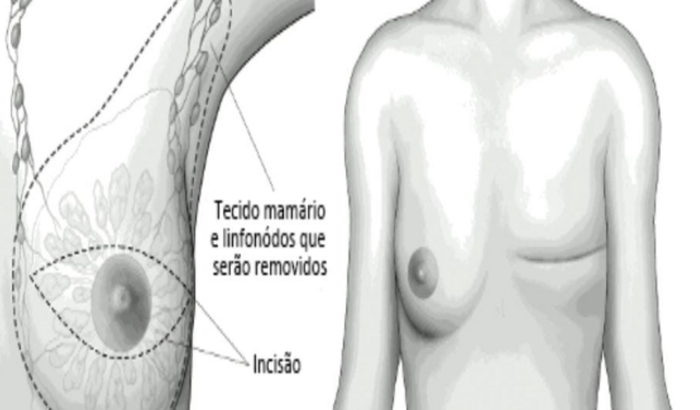 Nos ajude a combater o Câncer de Mama da Kacielen 