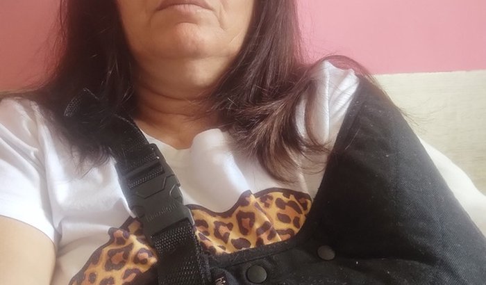 Cirurgia do supraespinhal com rotura transfixante de fibras