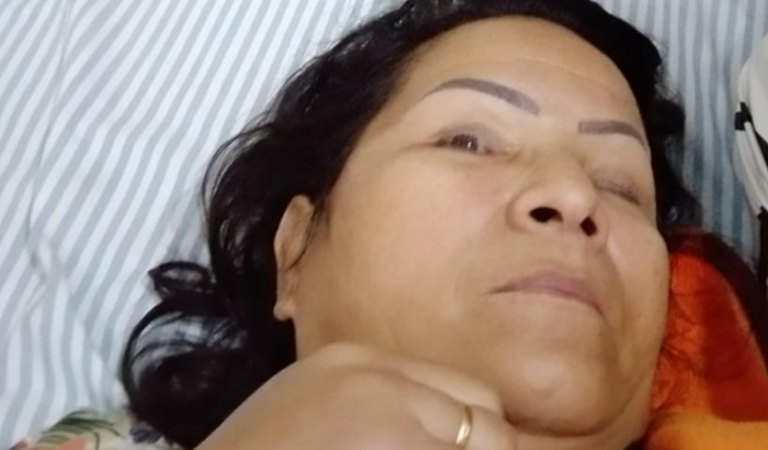 Tratamento após AVC da Claudete Gomes
