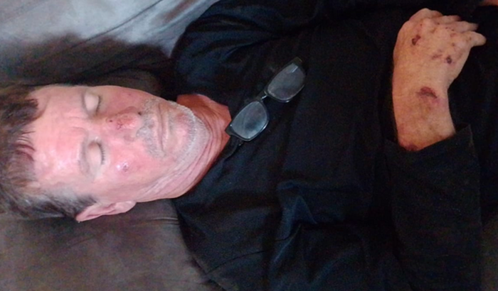 Ajuda para internação do meu Pai