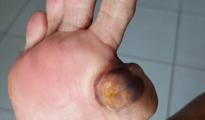 Ajuda para comprar sandália especial para Maria Francisca