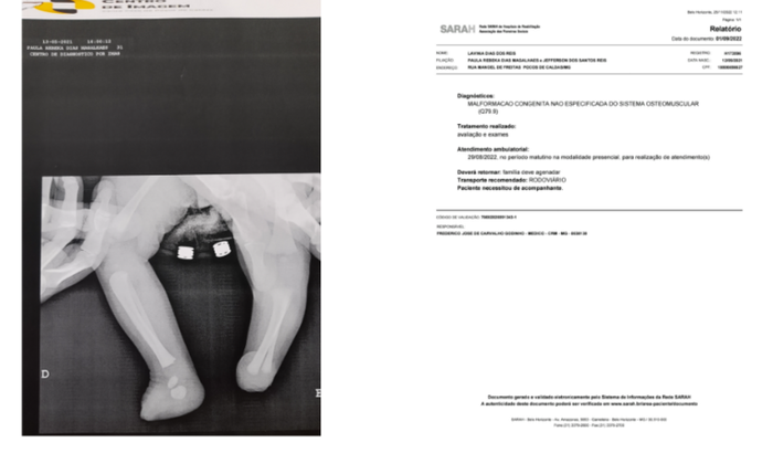 Ajude a Lavínia a comprar suas próteses
