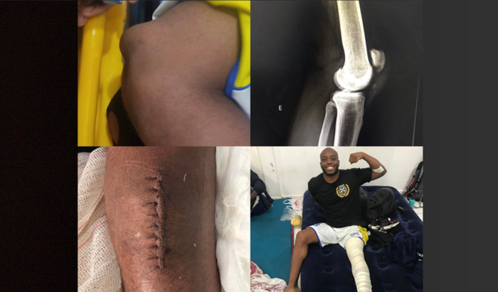 Reabilitação lesão de joelho do Anderson Gil