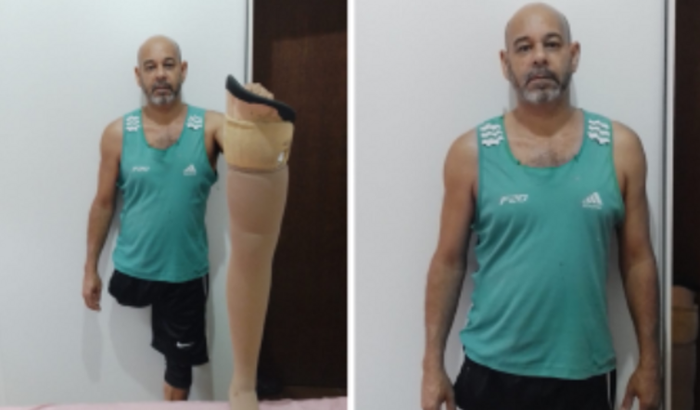 Prótese perna mecânica 