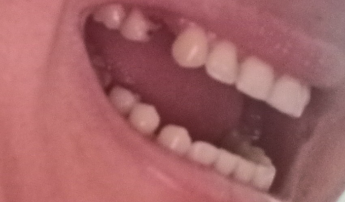 Kaitiana francelino de Lira