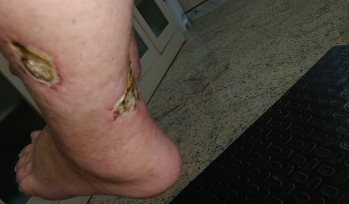 Cirurgia  do meu pai 